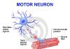 মটর নিউরন ডিজিজ; এক নীরবঘাতক